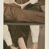 Pressure points on the leg.