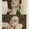 Bleeding from nose and mouth.