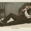 Epilepsy.