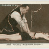 Artificial respiration.