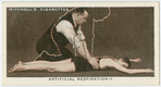 Artificial respiration.