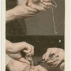Fish hook embedded in hand.