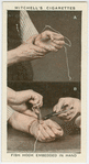 Fish hook embedded in hand.