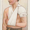 Triangular bandage.