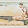 Artificial respiration.