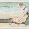 Artificial respiration.