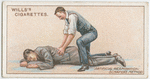 Artificial respiration.