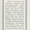 Fractured knee-cap.