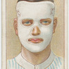 Burns on face.