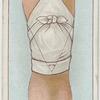 Triangular bandage for the knee.
