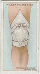 Triangular bandage for the knee.
