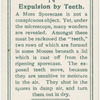 Expulsion by teeth.