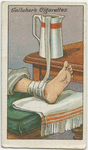 How to treat sprains.