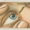 How to remove foreign particles from the eye.
