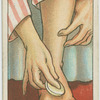 How to cure chilblains.