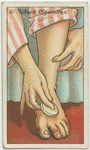 How to cure chilblains.
