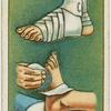 How to bandage a foot.