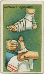 How to bandage a foot.