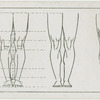 The legs.