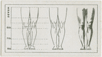 The legs.