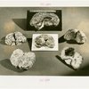 Bakelite Plastics Exhibit - Brains coated in plastic