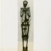 General Electric - X-ray skeleton of mummy