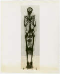 General Electric - X-ray skeleton of mummy
