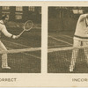 Backhand high volley.