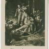 Nelson wounded at Teneriffe, 1797.