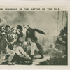 Nelson wounded in the Battle of the Nile.