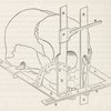 Diagram of the facial goniometer