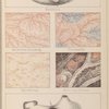 Diagrams of the stomach in various conditions