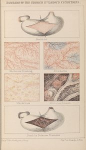 Temperance essays, and selections from different authors, collected and ed. by Edward C. Delavan ... Also a treatise on tobacco, by General John H. Cocke ...