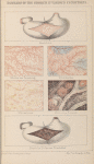Diagrams of the stomach in various conditions
