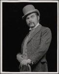 The Elephant Man, 1979