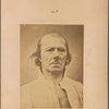 Fig. 3 : Physiological photograph, in repose - the face of an old man who served in numerous electrophysiological experiments, represented by photography in this album