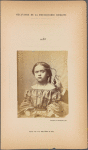 Fig. 10 : Showing the expressive of m. frontalis in a young girl (see her portrait, Fig. 5). On the left, electrization of m. frontalis, with development of the fundamental line (elevation and curvature of the eyebrow, without frontal folds) : Attention.