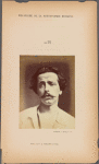 Fig. 24 : A stronger degree of voluntary contraction than in Fig. 23, in the same subject seen full face, in whom the eye is obliquely turned superiorly and laterally, compared to the contraction of m. frontalis, with the same movement of the eye.