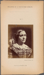 Fig. 26 : The median forehead wrinkles produced by the contraction of m. corrugator supercilii, in a 52-year-old woman, shown also in Fig. 11, whose skin is thin and burned by the wind and sun.