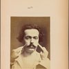 Fig. 16 : Showing that m. procerus terminate superiorly in the skin at the level of the heads of the eyebrows. Electrical contraction of both mm. procerus in a young man of gentle character (see his portrait, Fig. 4) : expression of severity.