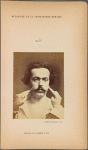 Fig. 16 : Showing that m. procerus terminate superiorly in the skin at the level of the heads of the eyebrows. Electrical contraction of both mm. procerus in a young man of gentle character (see his portrait, Fig. 4) : expression of severity.