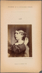Fig. 29 : Stronger electrical stimulation of m. corrugator supercilii with an upward gaze, in an 8-year-old girl : painful memories - an unnatural expression for this age.