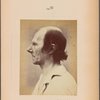 Fig. 37 : Portrait of the old man seen in profile (also shown in Fig. 3, 6, 7, 8, 9, 12, 13, 14, 17, 18, 19, 20, 21, 22, 30, 31, 32, 33, 34, 35, 36). Compare this with Fig. 38 and 39.