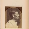 Fig. 40 : A portrait, seen in profile, of a man 42 years old, stupefied by the abuse of alcohol; his nose is aquiline. It serves to study the expressions produced by the transverse part of m. nasalis. Compare this to Fig. 41 and 42.