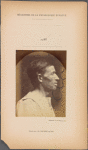 Fig. 40 : A portrait, seen in profile, of a man 42 years old, stupefied by the abuse of alcohol; his nose is aquiline. It serves to study the expressions produced by the transverse part of m. nasalis. Compare this to Fig. 41 and 42.