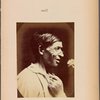 Fig. 42 : To show the grossness of and cynicism of the expression of lust in the same individual in whom the transverse part of m. nasalis is very well developed.