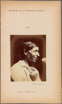 Fig. 42 : To show the grossness of and cynicism of the expression of lust in the same individual in whom the transverse part of m. nasalis is very well developed.