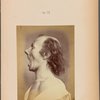 Fig. 55 : To show that it is not sufficient to open the mouth and elevate the eyebrows to portray astonishment. These movements may just produce a grimace, unless there is a perfect rapport between them.