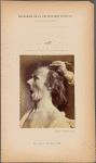 Fig. 57 : To study the combined maximal contraction of mm. frontalis and the muscles that lower the mandible. Voluntary maximal opening of the mouth and energetic electrical stimulation of mm. frontalis : astonishment, stupefaction, amazement.