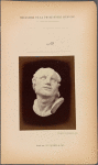 Fig. 69 : The same head as Fig. 67 on which the forehead lines and the sculpting of the later portion of the brow have been adapted to the obliqueness and the curvature of the eyebrow, true to the actions of m. corrugator supercilii